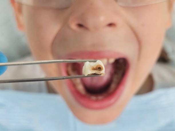 Best Urgent Dental Care in Lesslie, SC